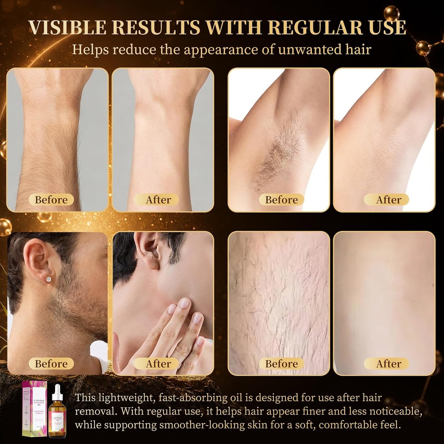 Natural Cyperus Rotundus Body Oil 60ml - Post-Shave & Post-Wax Moisturizer with Jojoba, Rosehip & Sweet Almond | Reduces Unwanted Hair Regrowth Appearance | Silky Smooth Skin for All Types